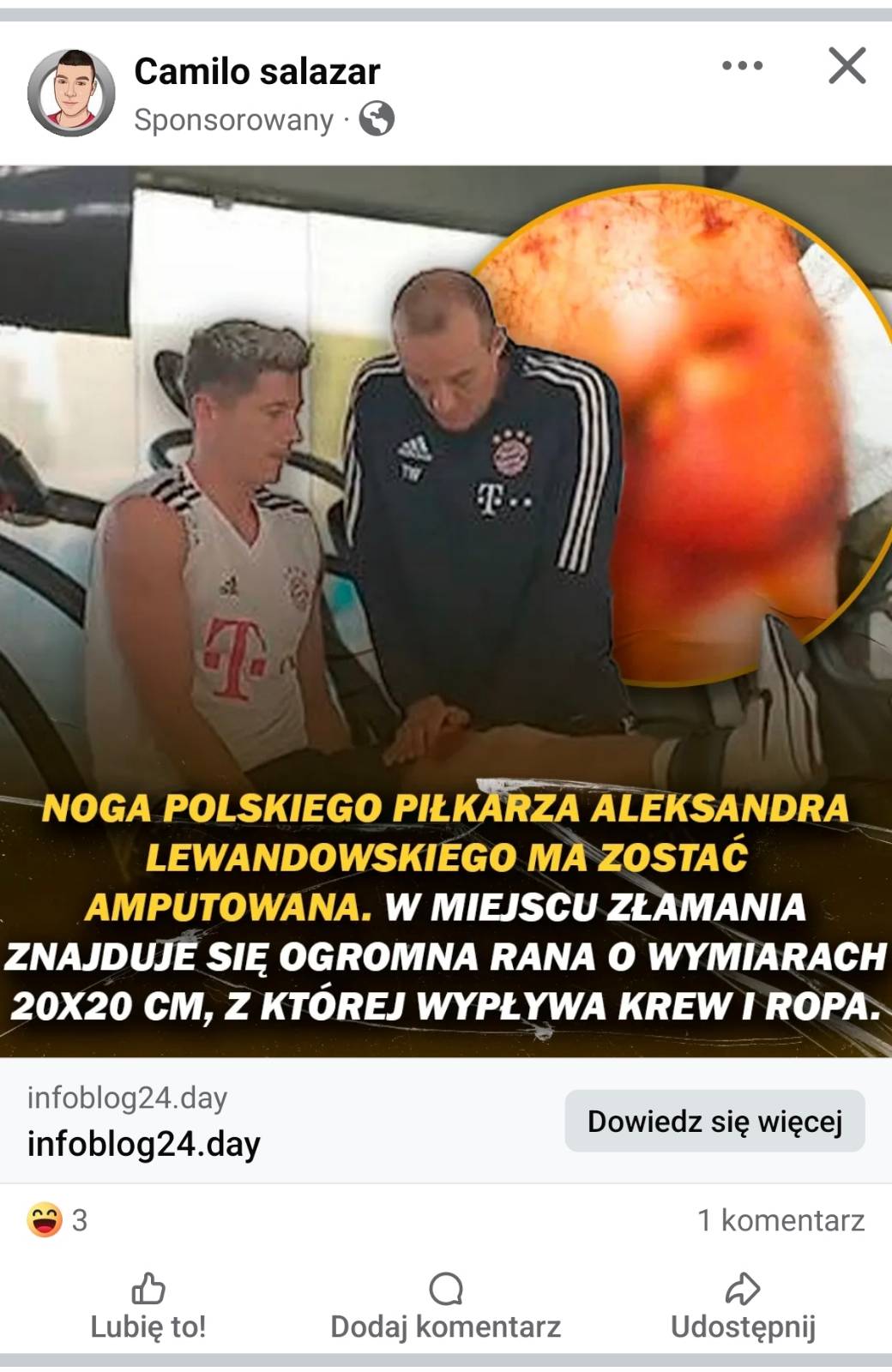 Robert Lewandowski złamał nogę? Nie - to oszustwo.